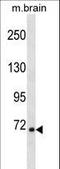 Ribosomal Protein S6 Kinase A1 antibody, LS-C158246, Lifespan Biosciences, Western Blot image 