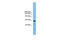 Uromodulin Like 1 antibody, ARP44475_P050, Aviva Systems Biology, Western Blot image 