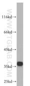 Calponin 2 antibody, 21073-1-AP, Proteintech Group, Western Blot image 