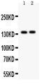 Period Circadian Regulator 2 antibody, LS-C357497, Lifespan Biosciences, Western Blot image 