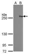 Tet Methylcytosine Dioxygenase 2 antibody, NBP2-43579, Novus Biologicals, Western Blot image 