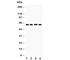 Hexosaminidase Subunit Alpha antibody, R30884, NSJ Bioreagents, Western Blot image 