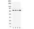 Mitogen-Activated Protein Kinase Kinase Kinase 3 antibody, R31024, NSJ Bioreagents, Western Blot image 