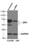 Zinc transporter ZIP4 antibody, 20625-1-AP, Proteintech Group, Western Blot image 