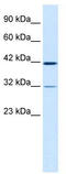 HEC-GlcNAc6ST antibody, TA339118, Origene, Western Blot image 