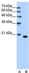 Phosphatidylethanolamine Binding Protein 1 antibody, TA346573, Origene, Western Blot image 