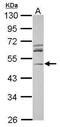 Actin Related Protein 3 antibody, PA5-30354, Invitrogen Antibodies, Western Blot image 