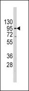 Telomerase Reverse Transcriptase antibody, PA5-11446, Invitrogen Antibodies, Western Blot image 