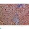 C-Type Lectin Domain Family 4 Member C antibody, LS-C813810, Lifespan Biosciences, Immunohistochemistry paraffin image 