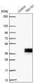 Testis Expressed 101 antibody, NBP1-84357, Novus Biologicals, Western Blot image 