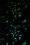 Steroidogenic Acute Regulatory Protein antibody, LS-C331212, Lifespan Biosciences, Immunofluorescence image 