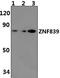 Zinc Finger Protein 839 antibody, PA5-75950, Invitrogen Antibodies, Western Blot image 