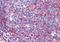 Thyroid Hormone Receptor Alpha antibody, orb89620, Biorbyt, Immunohistochemistry paraffin image 