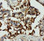 Annexin A8 antibody, PA1500, Boster Biological Technology, Immunohistochemistry paraffin image 