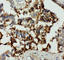 Annexin VIII antibody, PA1500, Boster Biological Technology, Immunohistochemistry paraffin image 