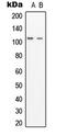 Tubulin Gamma Complex Associated Protein 3 antibody, LS-C353252, Lifespan Biosciences, Western Blot image 