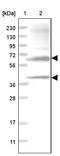 N-Sulfoglucosamine Sulfohydrolase antibody, NBP1-83164, Novus Biologicals, Western Blot image 