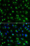 Golgi Associated, Gamma Adaptin Ear Containing, ARF Binding Protein 2 antibody, A04016, Boster Biological Technology, Western Blot image 