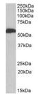 Aldehyde Dehydrogenase 5 Family Member A1 antibody, orb125067, Biorbyt, Western Blot image 