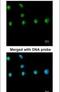 Nuclear Receptor Subfamily 2 Group F Member 1 antibody, PA5-21611, Invitrogen Antibodies, Immunofluorescence image 