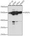 Serine/arginine-rich splicing factor 6 antibody, A04489, Boster Biological Technology, Western Blot image 