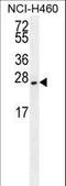 Eukaryotic Translation Initiation Factor 4E Family Member 2 antibody, LS-C167703, Lifespan Biosciences, Western Blot image 