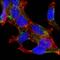 Alpha-Methylacyl-CoA Racemase antibody, A02217, Boster Biological Technology, Immunofluorescence image 