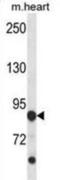 Cyclin Dependent Kinase Like 5 antibody, abx028535, Abbexa, Western Blot image 
