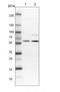 Elongator complex protein 3 antibody, NBP1-84625, Novus Biologicals, Western Blot image 