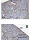 Tumor Protein P73 antibody, MA5-16183, Invitrogen Antibodies, Immunohistochemistry paraffin image 