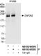 Zinc Finger MYM-Type Containing 4 antibody, NB100-95000, Novus Biologicals, Immunoprecipitation image 