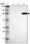 Mitochondrial Translational Initiation Factor 2 antibody, PA5-52242, Invitrogen Antibodies, Western Blot image 