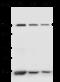 Clathrin Heavy Chain antibody, 106667-T40, Sino Biological, Western Blot image 