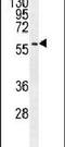 Speedy/RINGO Cell Cycle Regulator Family Member E3 antibody, PA5-23861, Invitrogen Antibodies, Western Blot image 