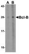 Bcl-2-like protein 10 antibody, A07380, Boster Biological Technology, Western Blot image 