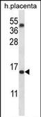 Transmembrane 4 L Six Family Member 18 antibody, PA5-71889, Invitrogen Antibodies, Western Blot image 