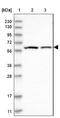 Potassium Voltage-Gated Channel Subfamily D Member 2 antibody, NBP1-87708, Novus Biologicals, Western Blot image 