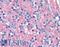Synaptosome Associated Protein 25 antibody, LS-B3684, Lifespan Biosciences, Immunohistochemistry paraffin image 