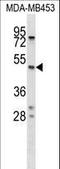 Serpin Family A Member 5 antibody, LS-C168980, Lifespan Biosciences, Western Blot image 