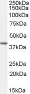 Vitamin D Receptor antibody, 45-169, ProSci, Enzyme Linked Immunosorbent Assay image 