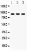 CCCTC-Binding Factor antibody, PA5-79087, Invitrogen Antibodies, Western Blot image 