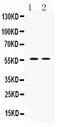 Angiopoietin Like 2 antibody, PA5-78776, Invitrogen Antibodies, Western Blot image 