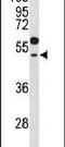 G Protein Subunit Alpha Transducin 1 antibody, PA5-26784, Invitrogen Antibodies, Western Blot image 