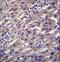 CTD Small Phosphatase 2 antibody, LS-C162902, Lifespan Biosciences, Immunohistochemistry paraffin image 