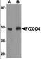 Forkhead Box O4 antibody, orb94535, Biorbyt, Western Blot image 