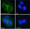 Corticotropin Releasing Hormone Receptor 1 antibody, LS-B15181, Lifespan Biosciences, Immunofluorescence image 