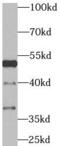 TNF Receptor Associated Factor 4 antibody, FNab08919, FineTest, Western Blot image 