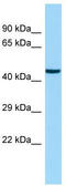 Selenocysteine-specific elongation factor antibody, TA338007, Origene, Western Blot image 