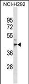 Metallophosphoesterase 1 antibody, PA5-49047, Invitrogen Antibodies, Western Blot image 