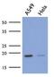 Mitochondrial Ribosomal Protein L58 antibody, GTX53730, GeneTex, Western Blot image 